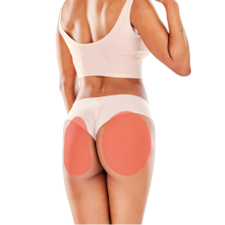 Gluteos